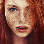 Sardas para todos os rostos